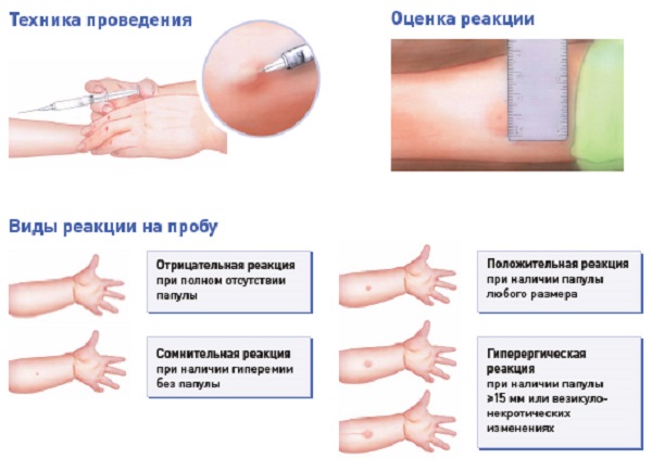 Техника проведения и виды реакций Техника проведения и виды реакций