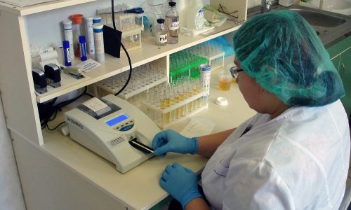 Определение эпителия проводится в осадке мочи, который является частью общего анализа