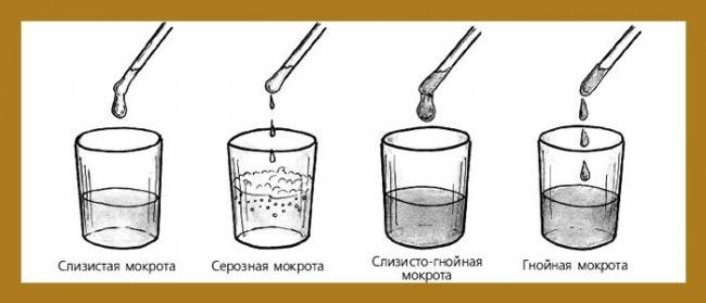 Разновидности мокроты Классификация мокроты