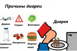 Основные причины диареи Основные причины диареи